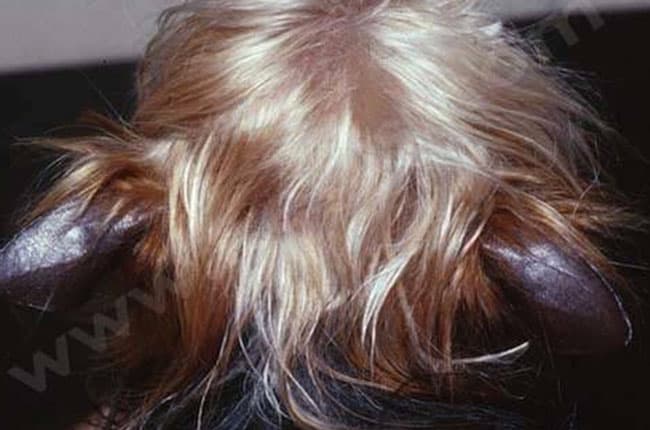 Syndrome des oreilles de cuir chez le chien