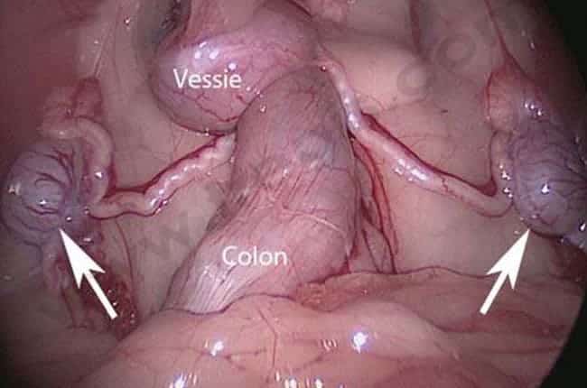 Testicule ectopique chez le chien