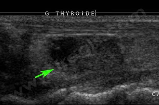 Hyperthyroïdie chez le chat