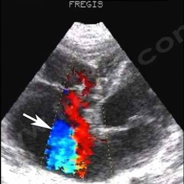 Malformations tricuspidiennes chez le chien