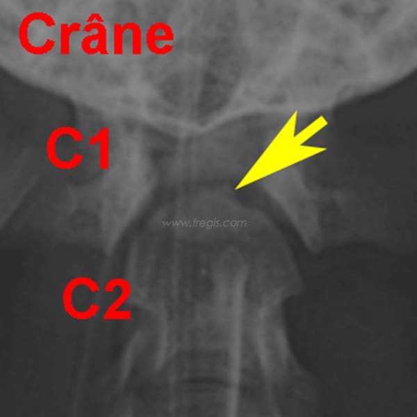 Subluxation atlanto-axiale chez le chien
