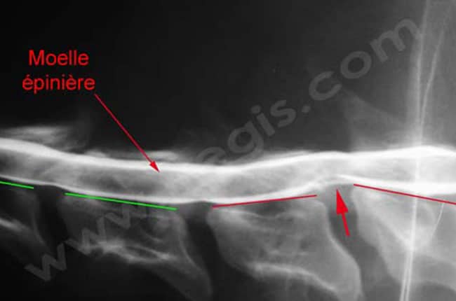 Syndrome de wobbler chez le chien