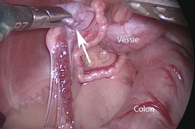 Testicule ectopique chez le chien
