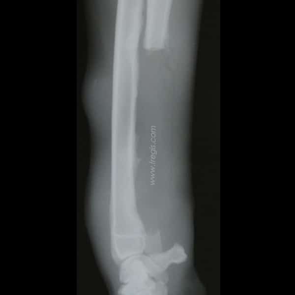 Chondrosarcome chez le chien