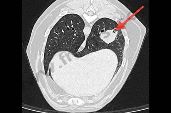 Tumeur pulmonaire chez le chat