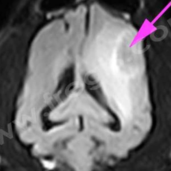 Tumeurs primitives du cerveau chez le chien