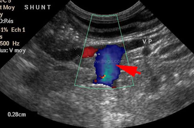 Diagnostic du shunt porto-systémique congénital chez le chien