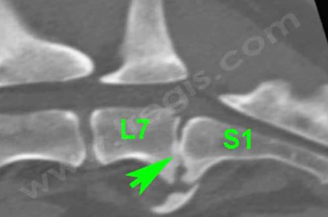 Discospondylite (ou spondylodiscite) chez le chien