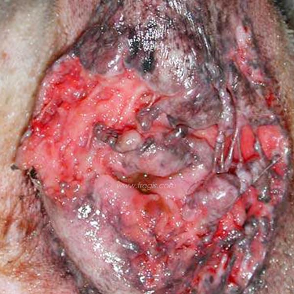 Fistules périanales (furonculose anale) chez le chien