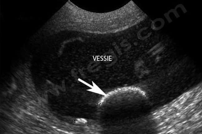 Calculs de la vessie (urolithiase, lithiase urinaire vésicale) chez le chien