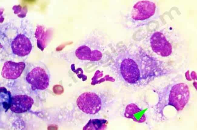 Panniculite nodulaire stérile idiopathique chez le chien