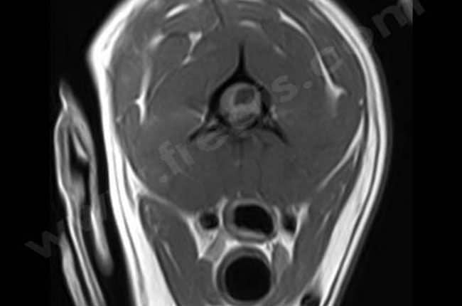 Syndrome de type Chiari chez le chien