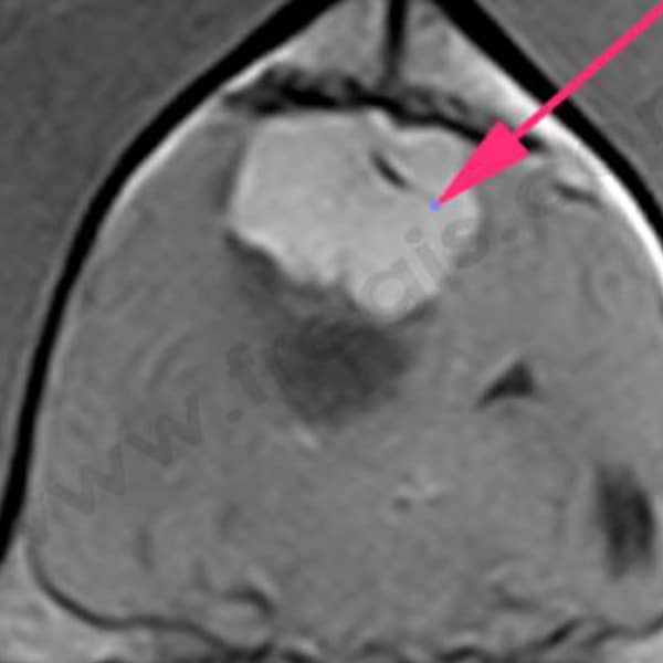 Tumeurs primitives du cerveau chez le chien