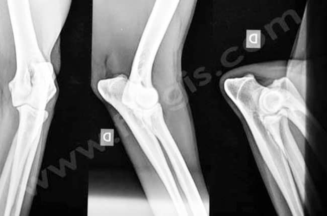 Dépistage radiographique d'une dysplasie du coude chez le chien