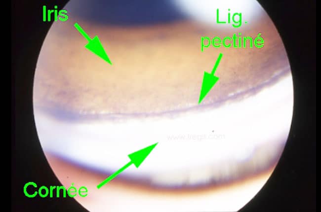 Dysplasie du ligament pectiné chez le chien