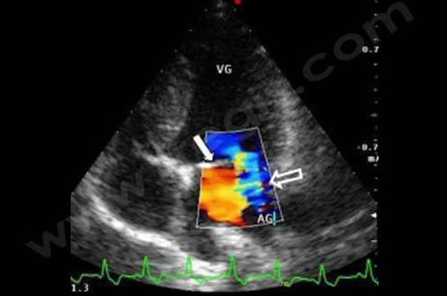 Endocardiose chez le chien