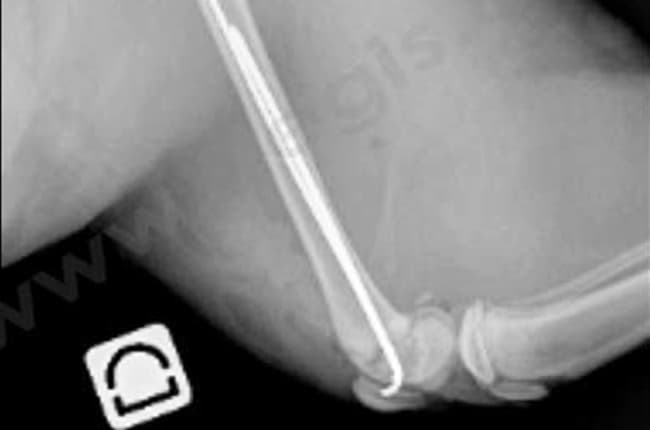 Fractures pédiatriques (ou fractures de type Salter Harris) chez le chat