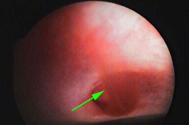 Hématurie rénale idiopathique chez le chien