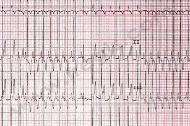 Urgences cardiaques chez le chien