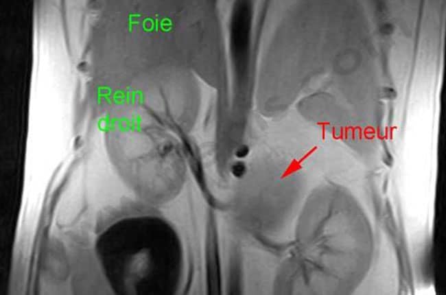 Tumeur du cortex surrénalien chez le chien