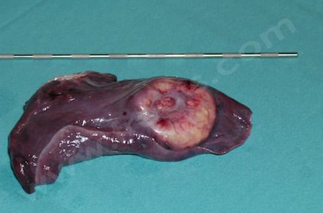 Tumeur pulmonaire chez le chien