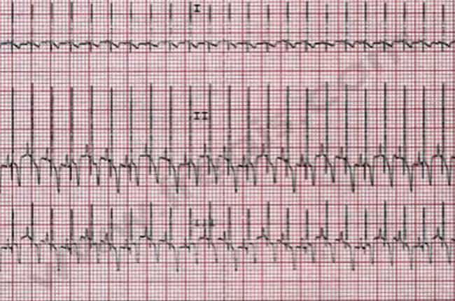 Urgences cardiaques chez le chien