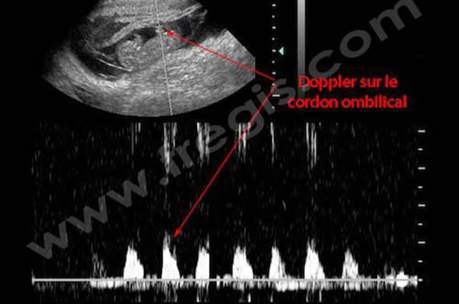 Gestation (Grossesse) chez le chienne
