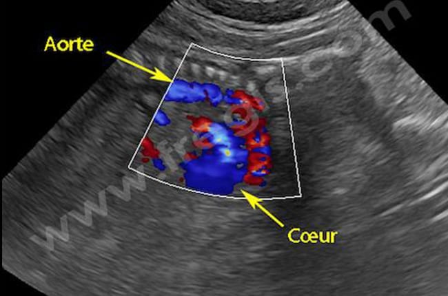 Gestation (Grossesse) chez le chienne