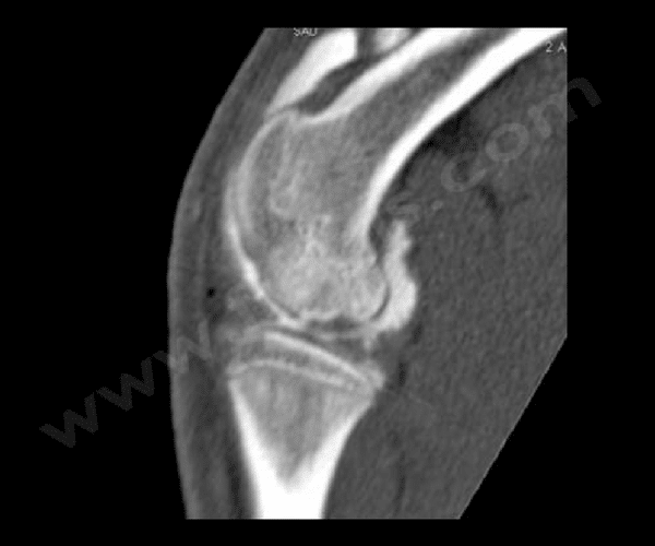 Arthroscanner