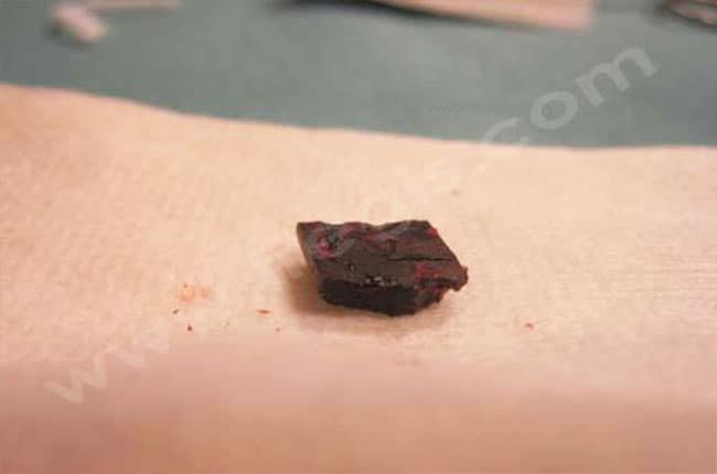 Chirurgie digestive chez les furets