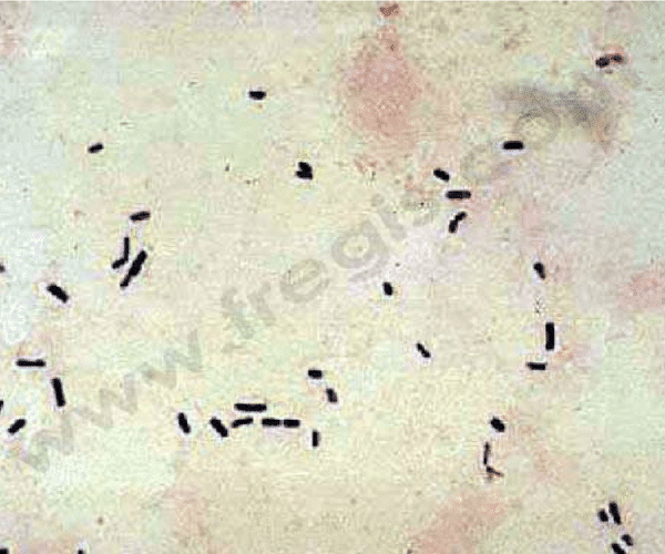 Clostridium