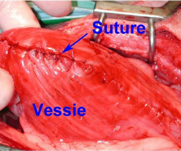 Cystotomie