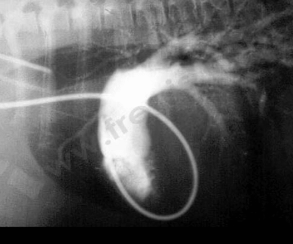Angiocardiographie