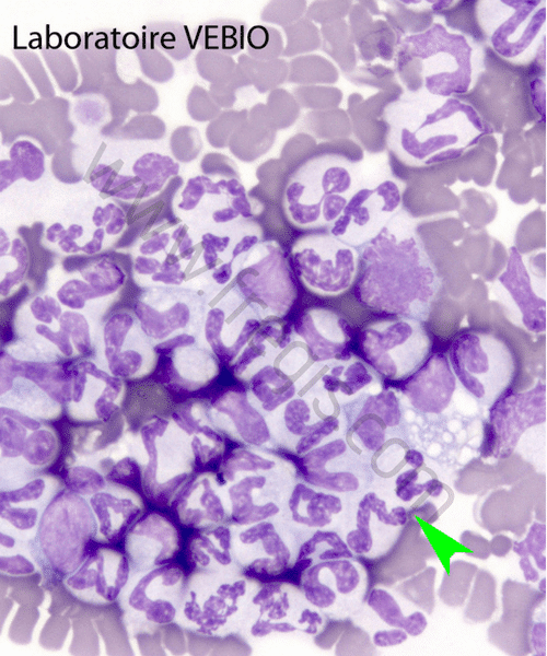 Globules Blancs
