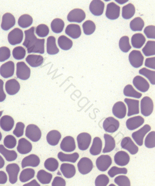 Globules Rouges