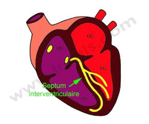 Septum interventriculaire (SIV)