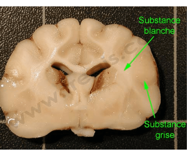 Substance blanche-grise