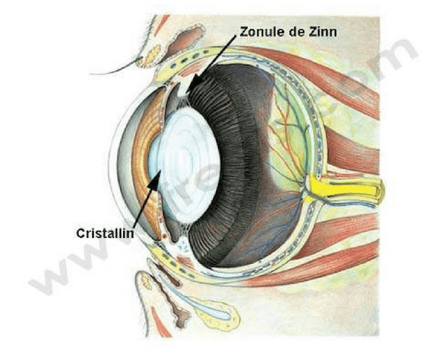 Zonule de Zinn