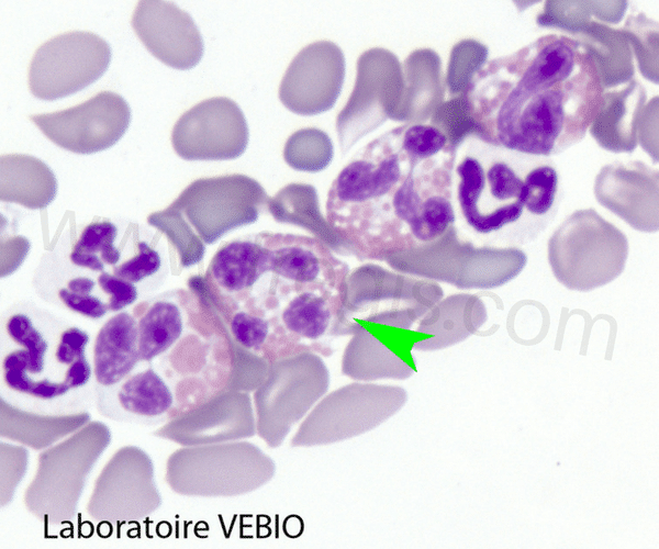 Les éosinophiles sont une variété de globules blancs (ou leucocytes).