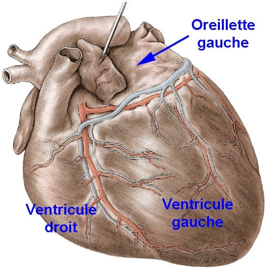 Oreillette Cardiaque Chez Le Chat Centre Hospitalier Veterinaire Fregis Oreillette Cardiaque Chez Le Chat Centre Hospitalier Veterinaire Fregis