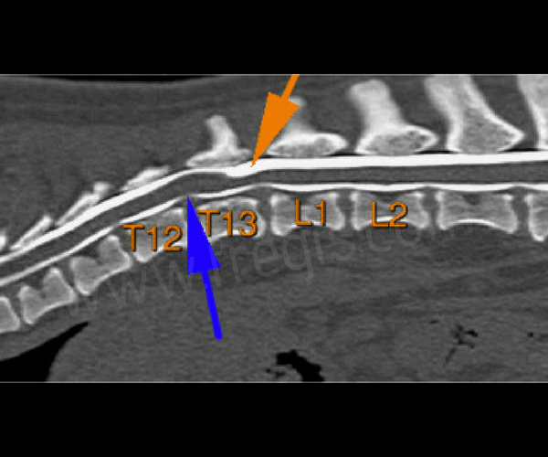 Myéloscanner sur un chien de race Carlin montrant un diverticule arachnoïdien (flèche orange) et discrète protrusion discale (flèche bleue).