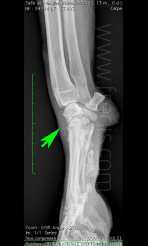 Radiographie en vue latérale du carpe d’un chien montrant un gonflement des tissus mous nécessitant une vue en contrainte pour poser le diagnostic.
