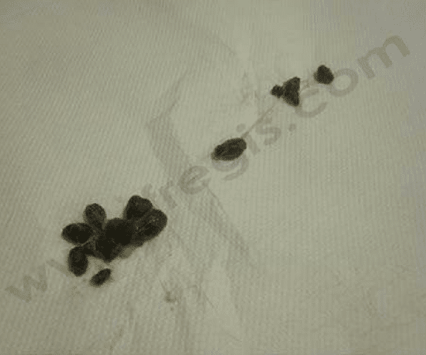 selles agglomérées par du mucus