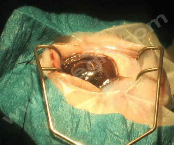 Chirurgie de cataracte chez un lapin