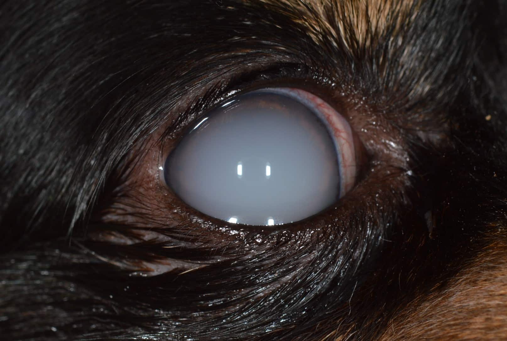 Opacification de la chambre antérieure de l’œil (entre la cornée et le cristallin), masquant l’iris et la pupille. Celle-ci était la conséquence d’une uvéite (inflammation intraoculaire) associée à un épanchement de lipides dans la chambre antérieure. La vision est altérée à ce stade mais le pronostic visuel est généralement bon après traitement.
