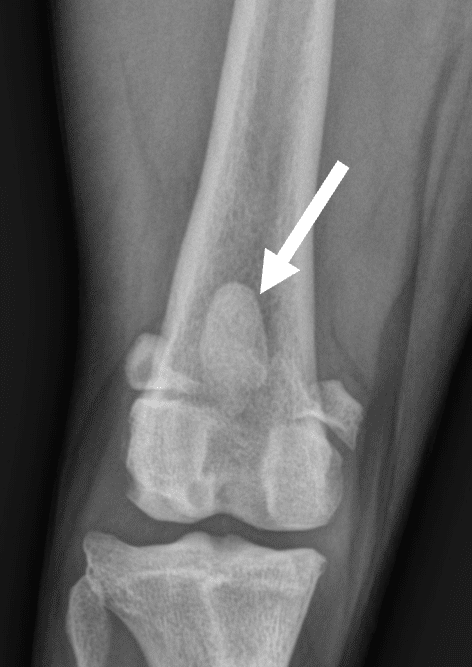 Radiographie de face d’une rotule normale chez un chien. La rotule est centrée sur le fémur. 