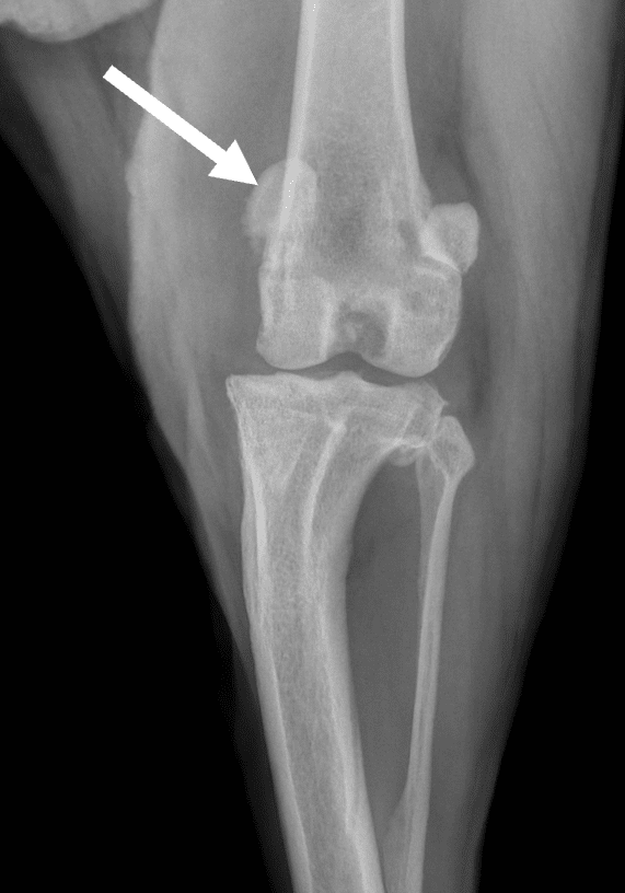Radiographie de face d&rsquo;une luxation m&eacute;diale de la rotule de grade 3 chez un chien. La rotule est d&eacute;plac&eacute;e vers l&rsquo;int&eacute;rieur