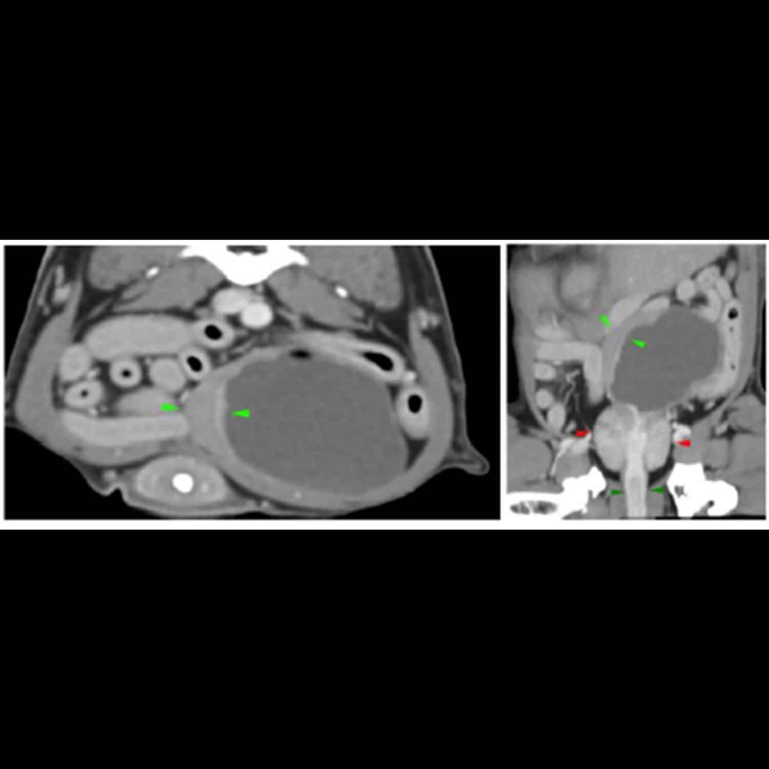 Scanner thoraco-abdominal