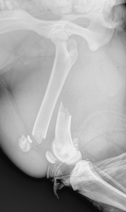 Radiographie de profil du fémur droit - Fracture du fémur, diaphysaire simple, oblique courte et comminutive, ouverte, chez un chien en fin de croissance