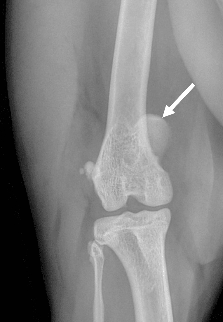 Radiographie de face d’une luxation médiale de la rotule de grade 3 chez un chat. 